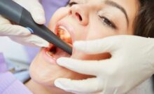 dentista carie