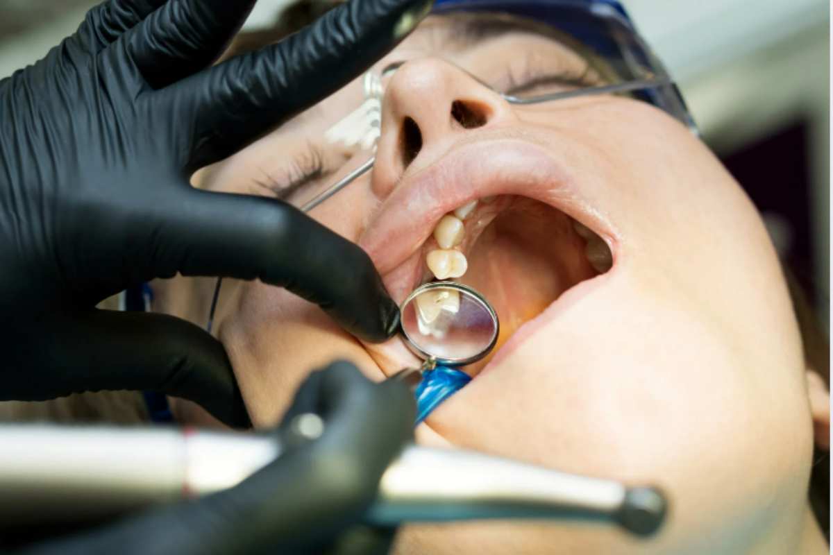 dentista trattamento
